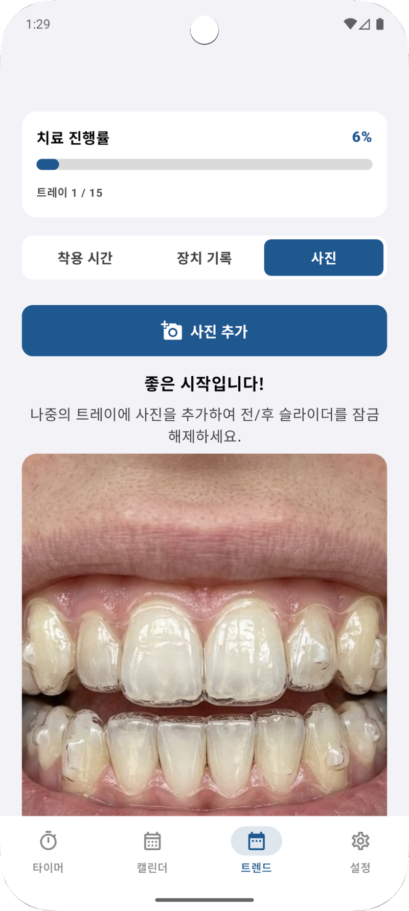스마일 진행 상황 사진