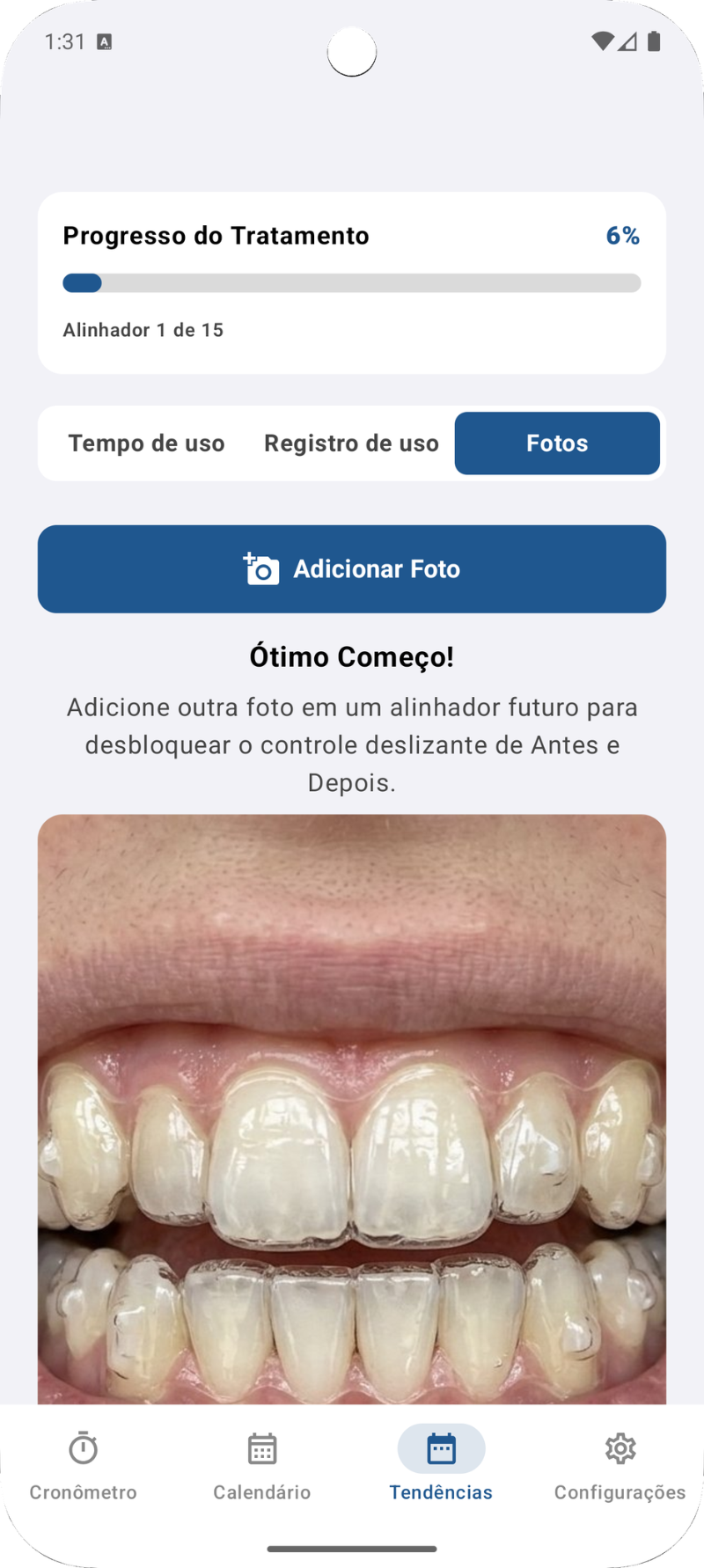 Fotos de Progresso do Sorriso
