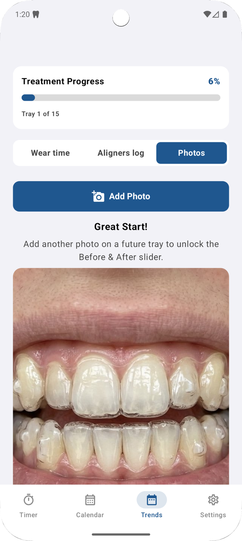 Smile Progress Photos